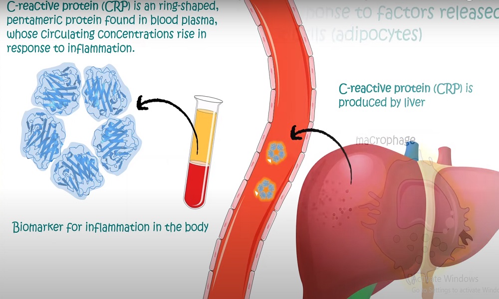 C-Reactive Protein (CRP)